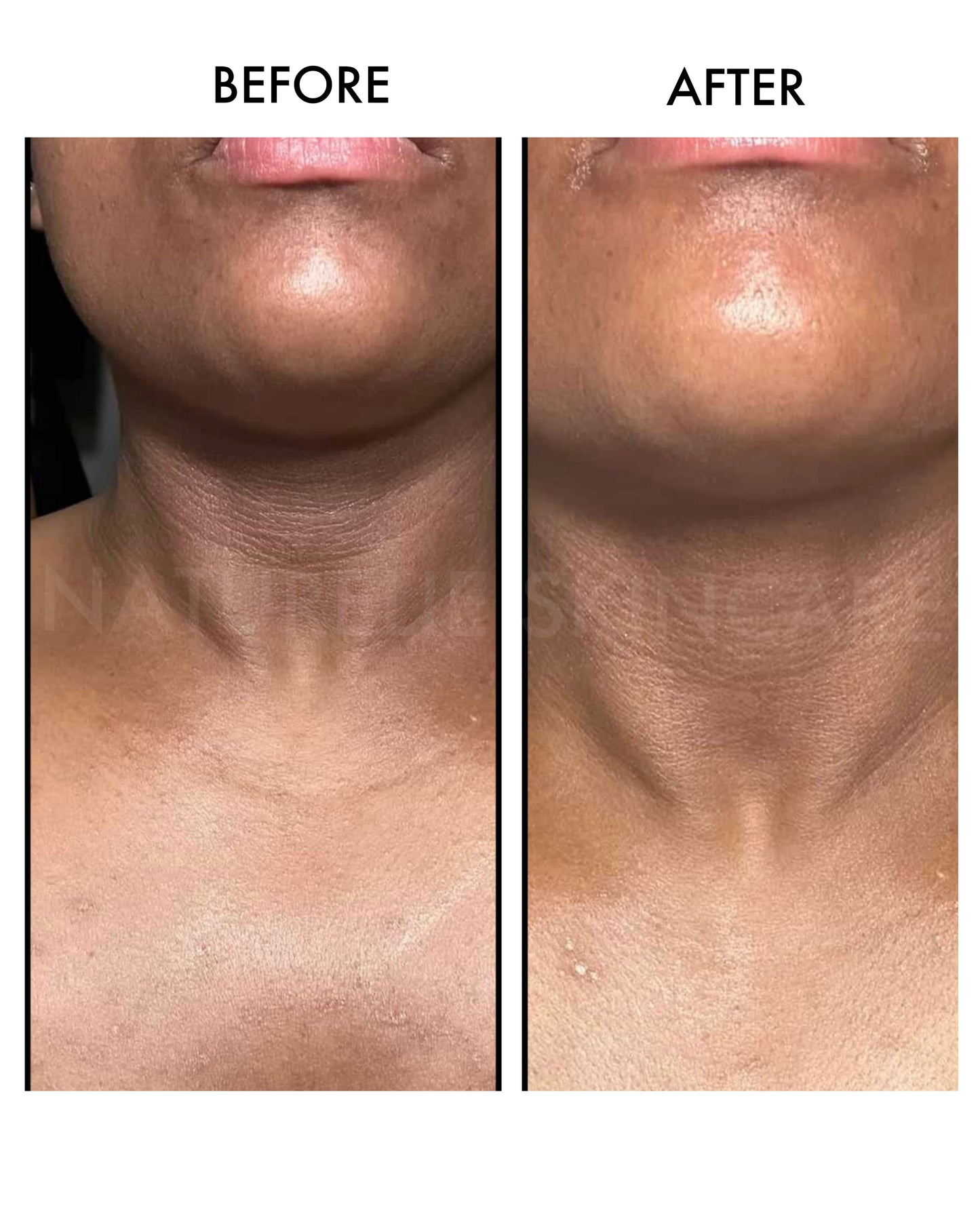 ECZEMA RELIEF FACE + BODY OIL
